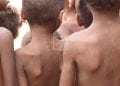 INSECURITE ALIMENTAIRE – Plus de 500.000 enfants du Sud menacés de malnutrition aiguë dont 110.000 de la forme sévère