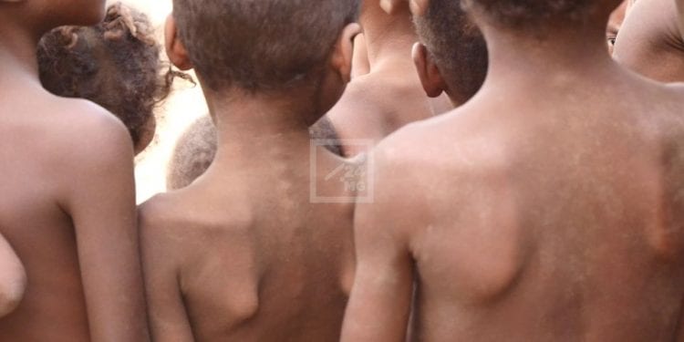 INSECURITE ALIMENTAIRE – Plus de 500.000 enfants du Sud menacés de malnutrition aiguë dont 110.000 de la forme sévère