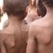 INSECURITE ALIMENTAIRE – Plus de 500.000 enfants du Sud menacés de malnutrition aiguë dont 110.000 de la forme sévère