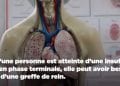 SANTE – La greffe des reins n’est pas pour tous les patients atteints d’insuffisance rénale