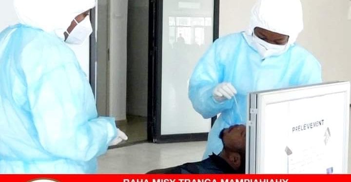 EPIDEMIE – Des tests de diagnostic rapide disponibles au niveau des Centres de santé de base pour renforcer la lutte contre la Covid-19 dans l’Analamanga et dans le Vakinankaratra