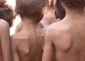 NUTRITION – 8,8 millions de Malgaches soit environ 33% de la population de Madagascar en situation d’insécurité alimentaire, selon la présentation de la Banque mondiale