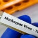 SANTE – L’OMS déclenche son plus haut niveau d’alerte mondiale face au virus Mpox ou la variole du singe