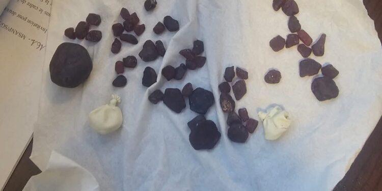 TRAFIC – 54 pièces de rubis de 59,3 grammes dissimulés dans le rectum d’un passager interceptés à l’aéroport d’Ivato